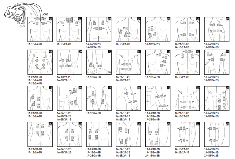 Миостимуляция живота схема наложения электродов